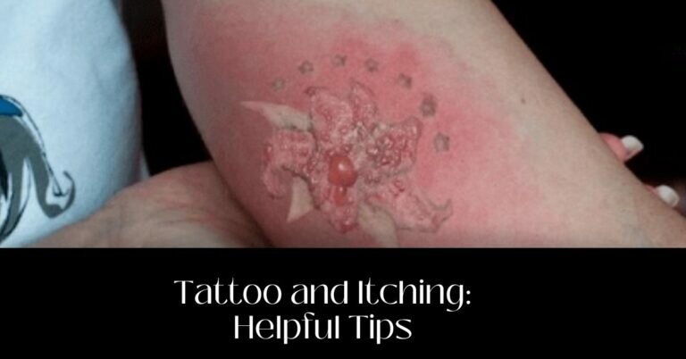 Tattoo And Itching | What Do You Do About That? Helpful Tips